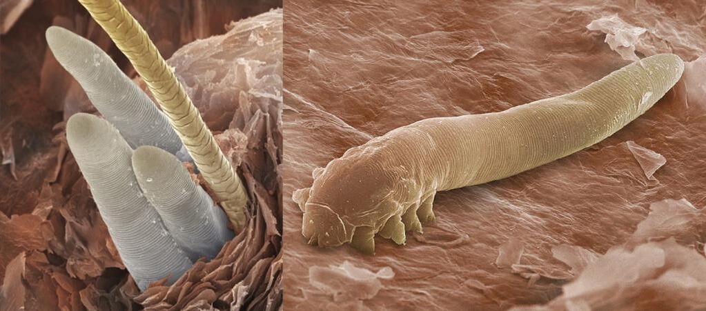 Ectoparsites