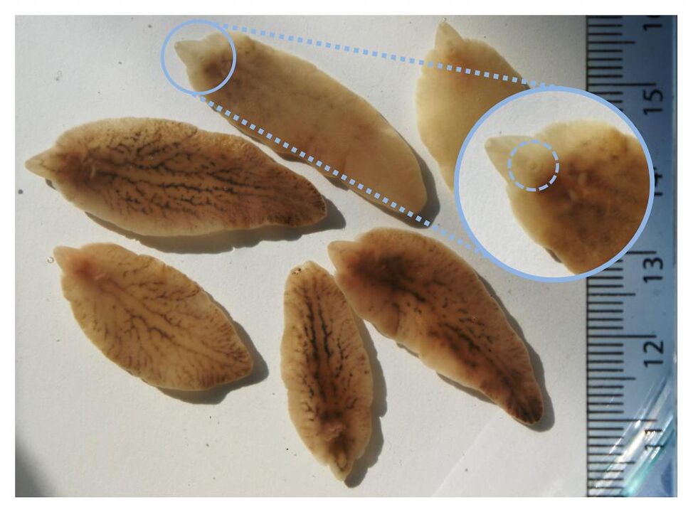 Liver fluke