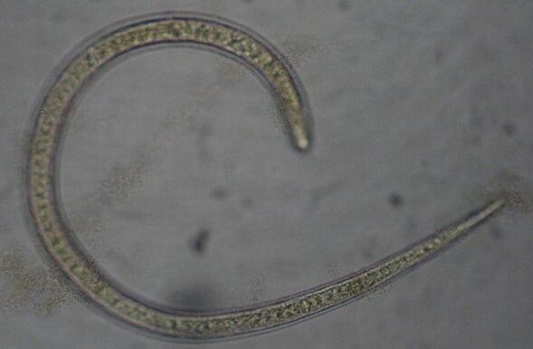 Trichinella is a protostome round parasitic worm