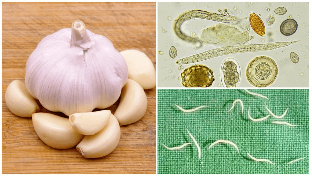 Parasites in the body folk methods