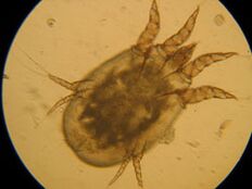Tick ​​under a microscope