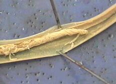 parasite